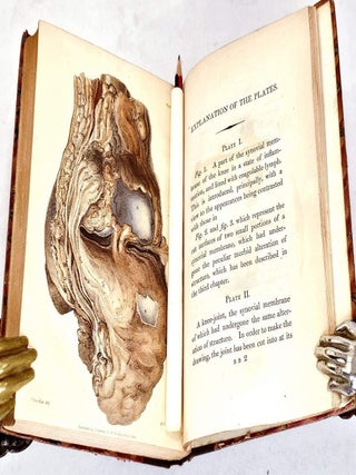 Item #105904 Pathological and Surgical Observations on the Diseases of the Joint (1822). B. C Brodie